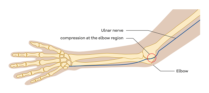 ulnar nerve ulnar nerve