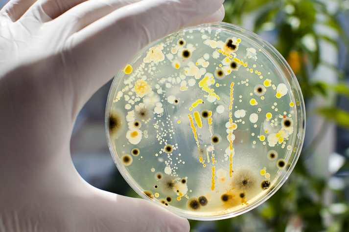 Researcher hand in glove holding Petri dish with colonies of different bacteria and molds on natural background.