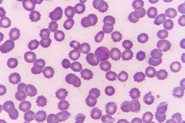 plasmodium malariae trophozoite purple cells under a microscope