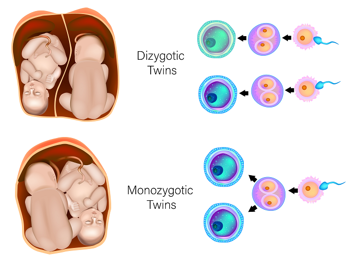 Monozygotic and Dizygotic Twins Educational Diagram.